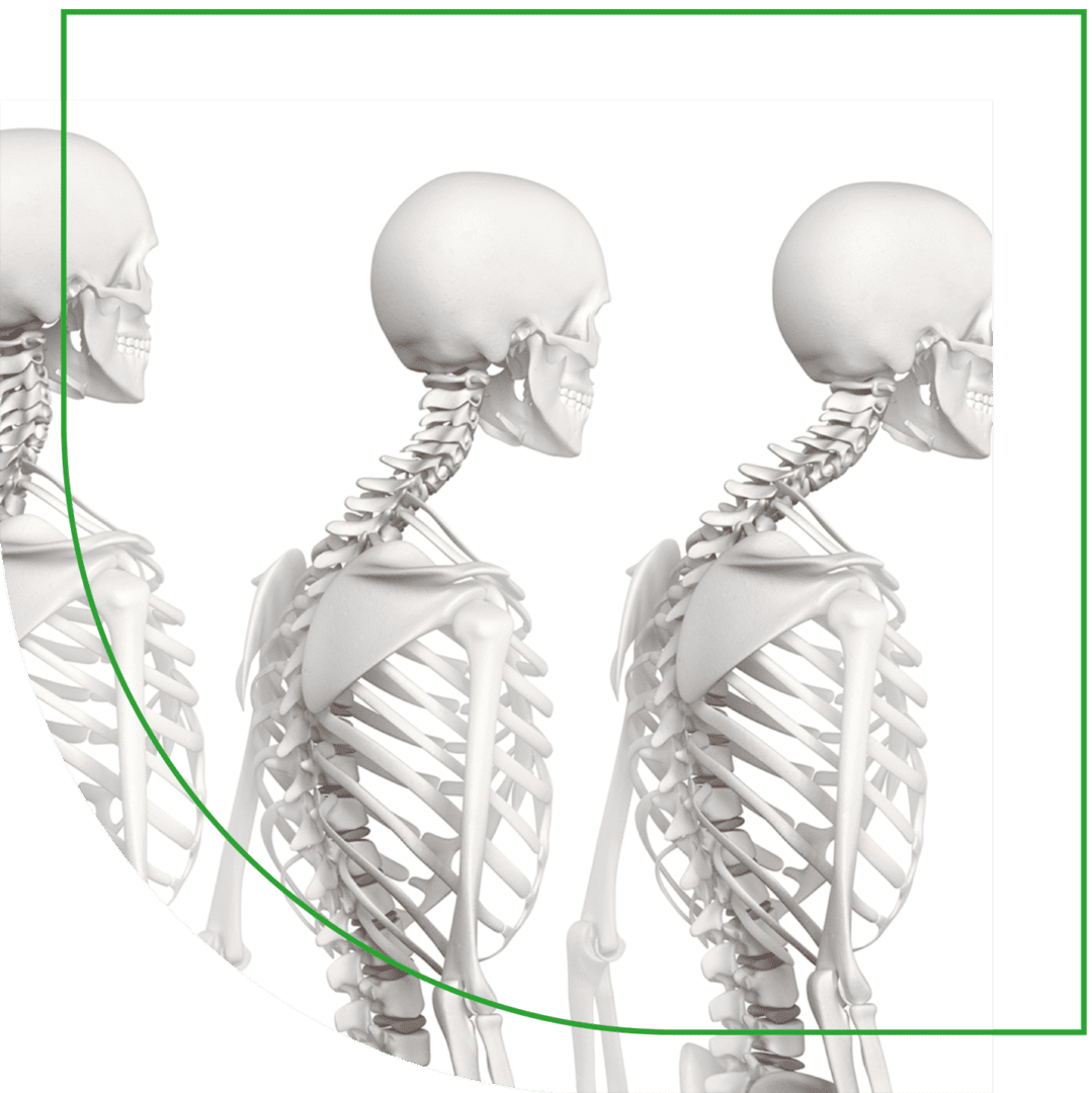 A picture of three skeletons with one green line in the middle.